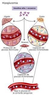 Hipoglucemia Diabetes Education Online