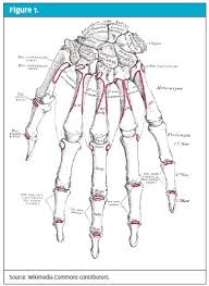 Image result for Fall on Outstretched Hand