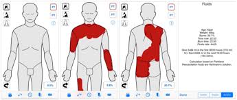 Online medical control (olmc) approval is required prior to performing an escharotomy. Major Trauma Burns Rcemlearning