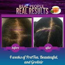 Natural Hair Biotin Before And After Would You Enjoy A Natural Alternative To Growing Your Hair Without Taking Pills Then Flow Tea Is For You Enriched With Bi Hair Growth Minoxidil Alopecia