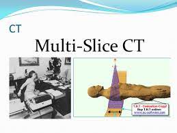Ct Multi Slice Ct Ppt Video Online Download