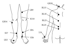Acupuncture Alleviated The Nonmotor Symptoms Of Parkinson S Disease Including Pain Depression And Autonomic Symptoms