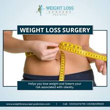 Pin On Weight Loss Surgery Pakistan