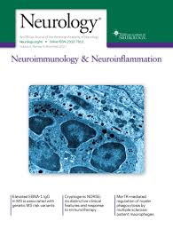 Image result for Microscopic Polyangiitis