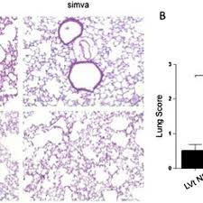Epidermis (keratinised stratified squamous epithelium) origin: Lung Tissue Histology A Representative Hematoxylin Eosin Stained Download Scientific Diagram