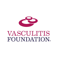 Image result for Vasculitis
