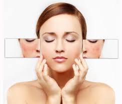 Laser Skin Treatment North County San Diego