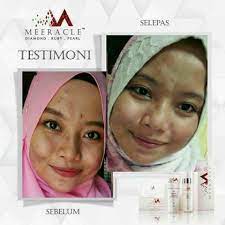 Ponds age miracle night cream 10 gr. Serik Dengan Produk Meeracle Gemstone Beauty Malacca Facebook