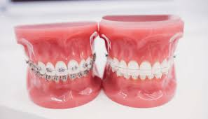 We did not find results for: 20 Myths About Braces Everyone Should Know Germantown Orthodontics