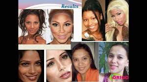 Black And White Bleaching Cream Side Effects Pin On Skin Whitening Products