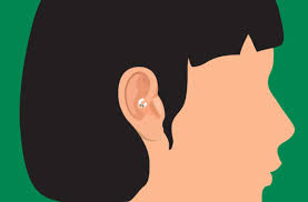 Can An Unconventional Piercing Rid You Of Migraine Pain Cleveland Clinic
