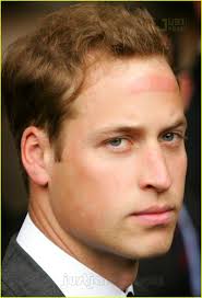Prince William has Hat Forehead: Photo 161031