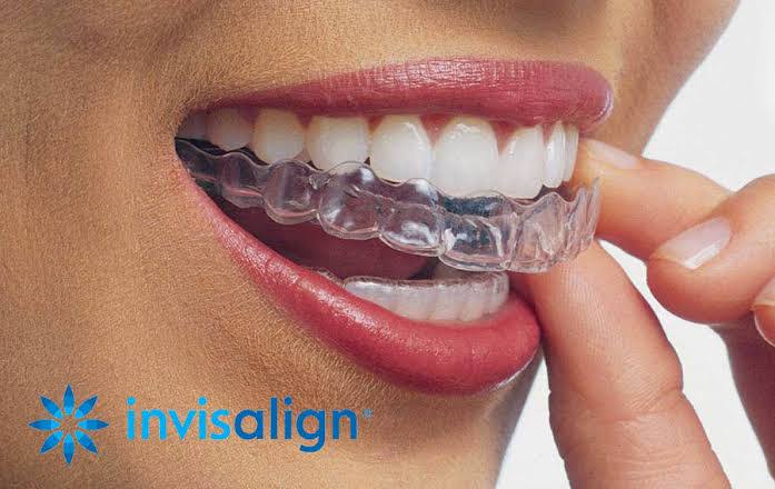 INVISALIGN product image