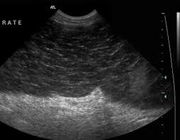 Sanguins d'un organe (notamment la rate, le cœur, le foie ou les reins). Torsion De La Rate Info Sante Centre Hospitalier Veterinaire Fregis