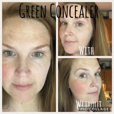 Can anyone recommend a concealer they used to hide post surgery bruises ? I  am Caucasian with fair skin. Thank you!