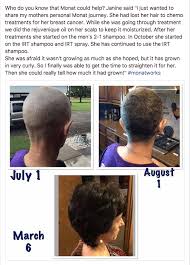 Pin By Kristen Kurey On Monat Monat Hair What Causes Hair Loss Hair Regrowth Shampoo