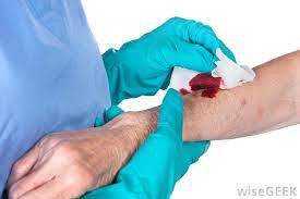 Clean the wound with the antiseptic solution two or three times a day, and apply the antibiotic ointment until the skin is healed. What Is A Sterile Dressing With Pictures