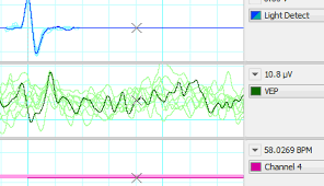 Labchart Life Science Data Acquisition And Analysis Software