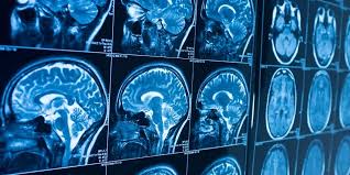 How do i become an xray tech? Radiologist Vs Radiology Tech What S The Difference