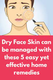 Dry Face Skin Can Be Managed With These 5 Easy Yet Effective Home Remedies Dry Skin Is A Challenge Faced By Almost Everyone Dry Skin On Face Dry Face Face Skin