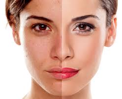 An exclusive word that can only be used by people of certain ranking. Bb Glow Perfect Skin Beauty Soul