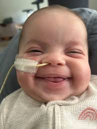 When do babies start holding their head up and what to do if they have flat  head syndrome?