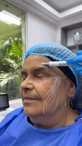 Stephany Carmona (@flawlessskinrd) • Instagram photos and videos