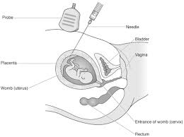 The uterus is a distensible organ the size of a closed fist. Diagnostic Tests For Your Baby During Pregnancy