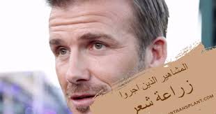 مسلسل ليه لا الموسم الثاني. Ø§Ù„Ù…Ø´Ø§Ù‡ÙŠØ± Ø§Ù„Ø°ÙŠÙ† Ø§Ø¬Ø±ÙˆØ§ Ø²Ø±Ø§Ø¹Ø© Ø´Ø¹Ø±