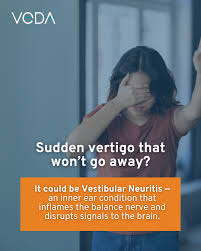 Image result for Vestibular Neuronitis