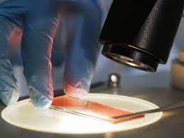 To keep track of how well cancer treatments are working and check cancer type: Bone Marrow Biopsy What To Expect What It Is And Risks