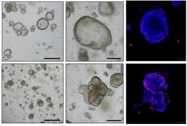 The colon is also called. Cancer Cell Reversion May Offer A New Approach To Colorectal Cancer Treatment Eurekalert Science News