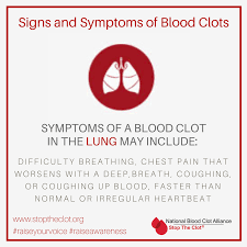 Coughing up blood is not the same as bleeding from the mouth, throat, or gastrointestinal tract. Stop The Clot A Blood Clot In Your Lung Also Known As Pulmonary Embolism Or Pe Can Be Life Threatening If You Experience Any Of These Symptoms Go To The Hospital Or