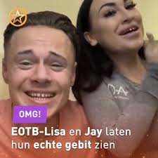 De onderste rij van zijn gebit met facings is namelijk donkerder dan de bovenste. Facebook