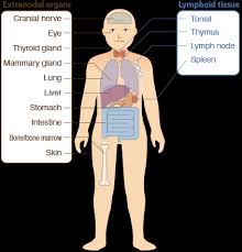 Image result for Lymphoma