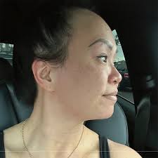 Medical Spa San Diego