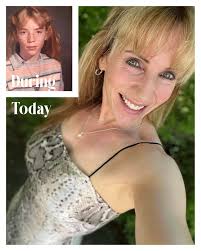 Natural cream for photo contact allergic dermatitis