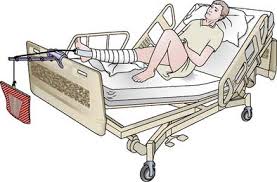 These fractures are further divided into different subsets depending on the traditionally, proximal femur fractures are therefore divided into groups based on their location with regard to the capsule, i.e. Nursing Patients With Musculoskeletal Disorders Nurse Key