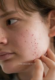 20 RECETAS PARA MANTENERTE JOVEN Y RADIANTE