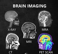 3 What S The Difference Between All The Different Head Scans Xray Ct Mri Mra Pet Scan And What They Show Brain Images Pet Scan Medical School Studying