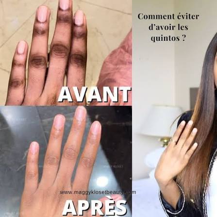 Comment éviter les quintos ? Nous savons tous que prévenir vaut mieux que  guérir 🤩 Voici des gestes simples pour garder une peau saine et uniforme.  : 🧤Utilisez toujours des gants lors
