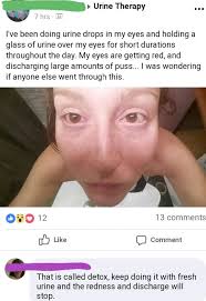 Urine Drops In My Eyes Trashy