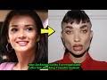 Amy Jackson Looks Unrecognizable after her shocking Plastic Surgery,  fillers and Botox