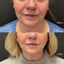 Swisher Skin and Laser...