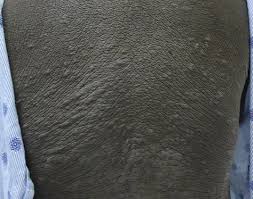 Image result for Thesium nigricans