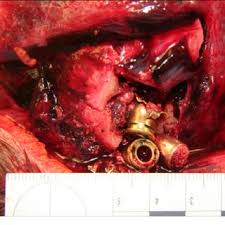 Maybe you would like to learn more about one of these? A 7 65 Mm Caliber And Two 7 65 Mm Caliber Shell Casings Recovered From Download Scientific Diagram