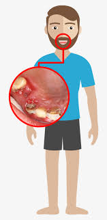 Pancreas Cartoon Png Image Transparent Png Free Download On Seekpng Sur.ly for joomla sur.ly plugin for joomla 2.5/3.0 is free of charge. seekpng