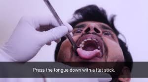 Healthcare Throat Swab Collection Procedure Youtube