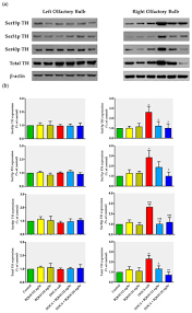 Ijms March 2018 Browse Articles