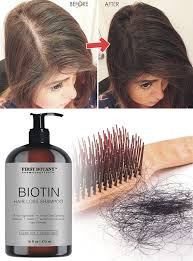 In this review, we are going to look at those treatments that are backed by evidence and discuss how they work so that you can make the best choice to treat your receding hairline. Hair Regrowth And Anti Hair Loss Shampoo 16 Fl Oz With 14 Dht Blocker First Botany